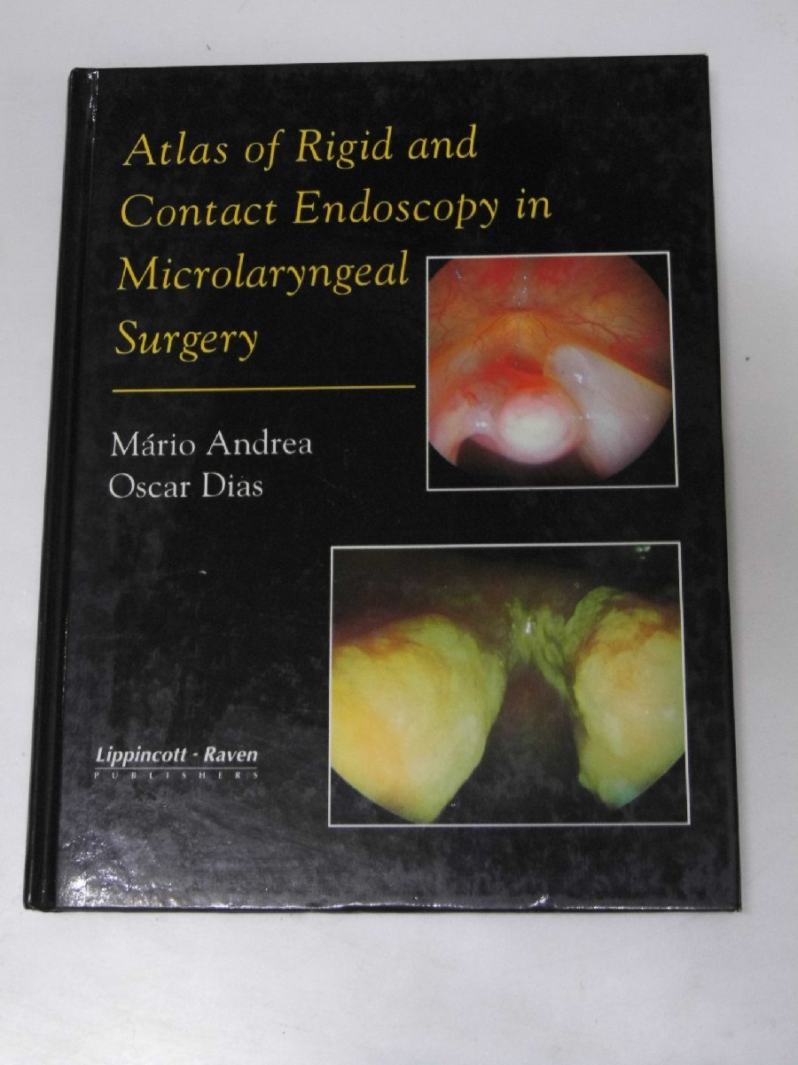Glp_302720　Atlas of Rigid and Contact Endoscopy in Microlaryngeal Surgery　Mario Andrea/Oscar Dias