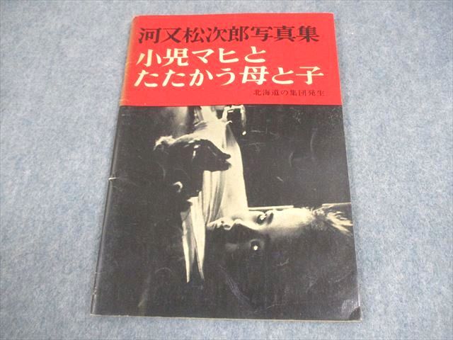 【初売り】 小児マヒとたたかう母と子 河又松次郎写真集 研光社 EC02-035 北海道の集団発生 07s6D 1961 ドキュメント