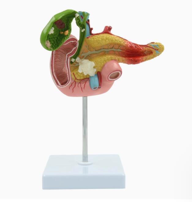 人気品サイズライフ 1:1 大解剖 人間 膵臓指腸胆嚢 病理 完成品 モデル 膵臓 模型 大学 模型 病院 教材 学習 病理学 PVC
