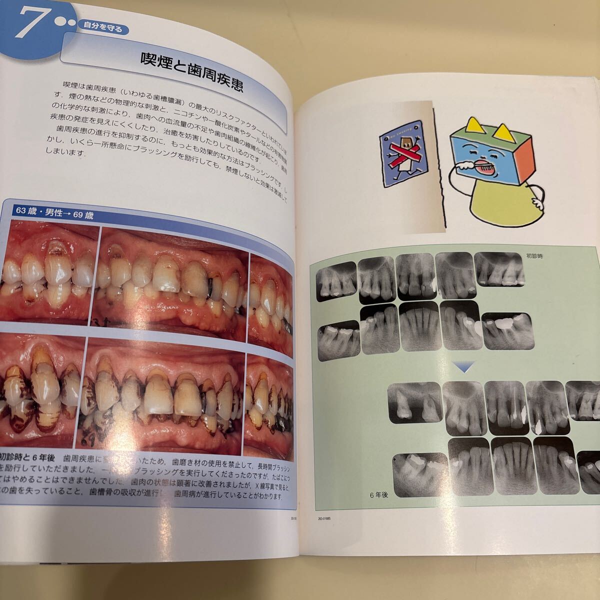 歯科本　歯科醫(yī)院待合室本　喫煙と歯肉　口からみえるたばこの害　新裝版 松岡晃／著　定価2,600円