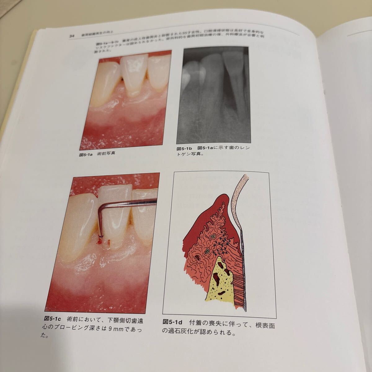 歯科本　歯周組織再生の向上　エナメル基質(zhì)タンパクの臨床応用 定価6,500円