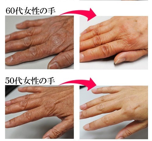 ヤフオク 手肌年齢改善 10歳 老け手 シワ たるみ くすみ ヤフオク 手肌年齢改善 10歳 老け手 シワ たるみ くすみ