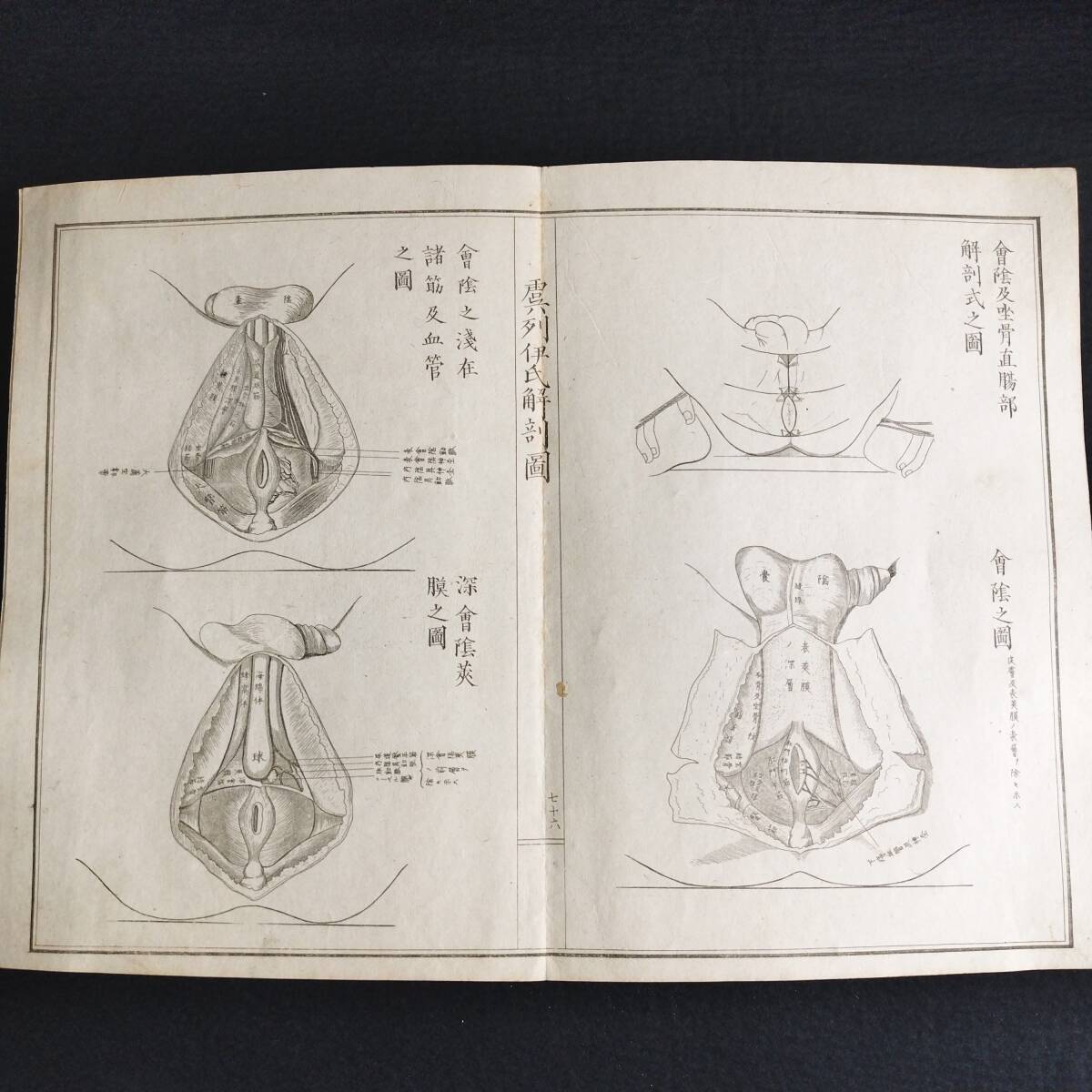Y322 人体解剖学 絵入絵本◇虞列伊氏解剖訓蒙図◇全2冊揃 性器 Y322 人体解剖学 絵入絵本◇虞列伊氏解剖訓蒙図◇全2冊揃 性器