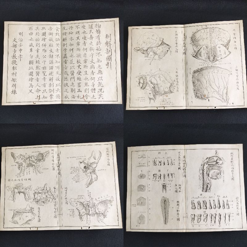 Y322 人体解剖学 絵入絵本◇虞列伊氏解剖訓蒙図◇全2冊揃 性器 Y322 人体解剖学 絵入絵本◇虞列伊氏解剖訓蒙図◇全2冊揃 性器