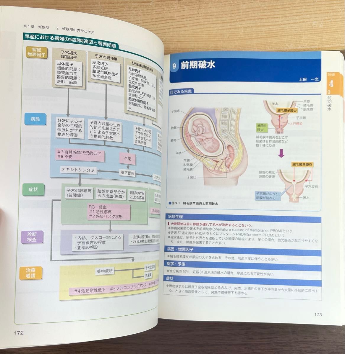 ウエルネスからみた母性看護過程+病態関連図 | 佐世 正勝／石村