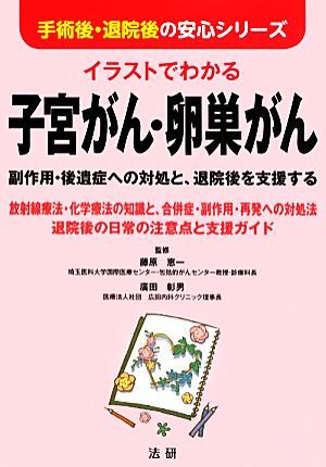 イラストでわかる子宮がん?卵巣がん 副作用?后遺癥への対処と、退院后を支援する 手術后?退院后の安心シリーズ/藤