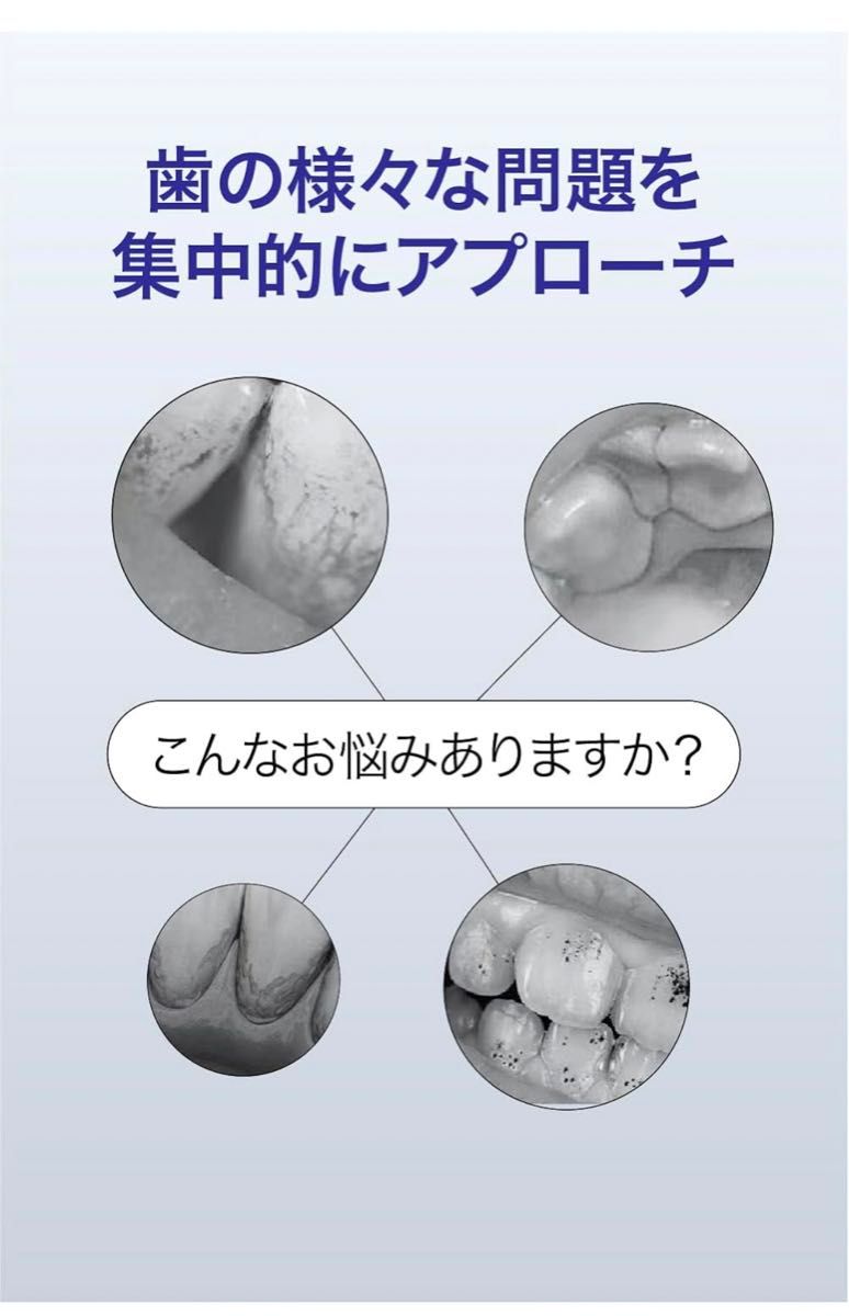  超音波歯間クリーナー 歯 クリーナー 口腔洗浄器 家庭用歯清潔器 USB 充電式 携帯用歯清潔器 クリーニング 高周波振動