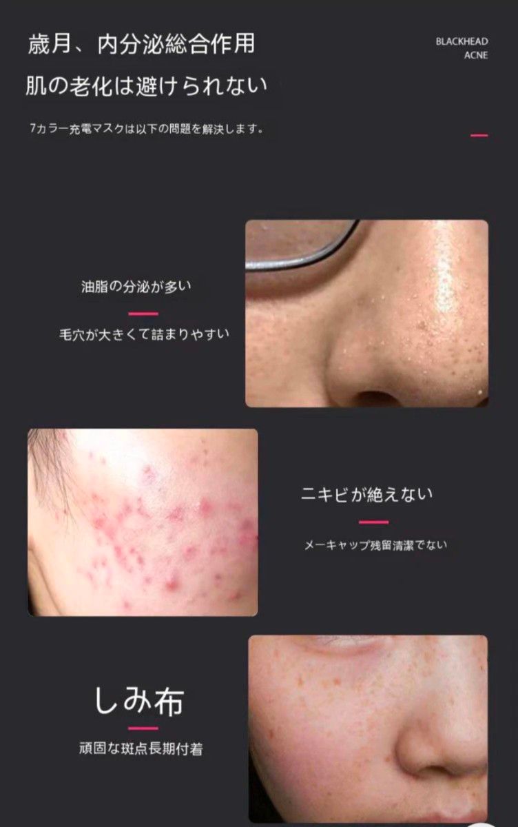 7色LED美顔器 RF美容マスク韓国ニキビ取りマスク シワ リフト 7色LED美顔器 RF美容マスク韓国ニキビ取りマスク シワ リフト