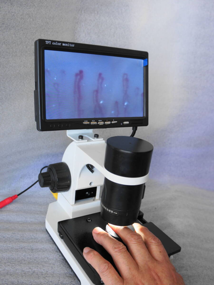 高倍率　血流スコープ　顕微鏡 高性能レンズ　９インチ モニター付き Amazon.co.jp: 血流スコープ 毛細血管顕微鏡 9インチモニター
