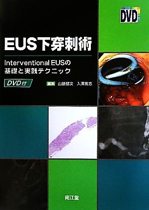 ＥＵＳ下穿刺術 Ｉｎｔｅｒｖｅｎｔｉｏｎａｌ　ＥＵＳの基礎と実践テクニック／山雄健次，入澤篤志【編】 71U9KW42cjL.jpg
