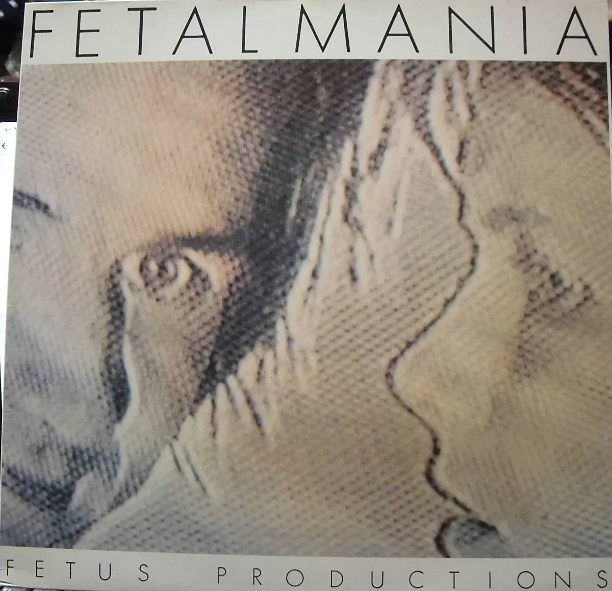 試聴美盤【 Experimental /80's New Wave 】Fetus Productions - Fetalmania /Normal (Germany)LP/What's Going On_画像1