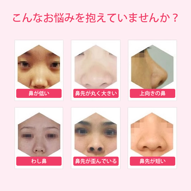 鼻クリップ ノーズクリップ 鼻 高く 美鼻 小鼻 鼻用 ノーズフィット サポート グッズ 軽量 シリコン 男女兼用 フィット アイテム ケアグッ_画像2