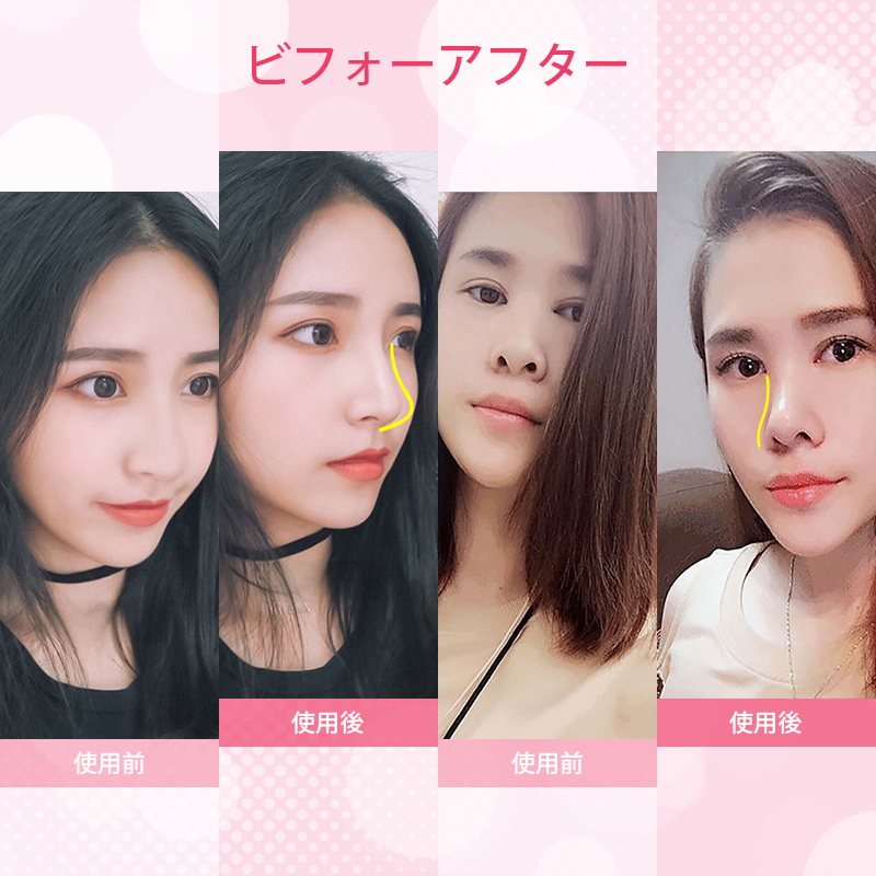 鼻クリップ ノーズクリップ 鼻 高く 美鼻 小鼻 鼻用 ノーズフィット サポート グッズ 軽量 シリコン 男女兼用 フィット アイテム ケアグッ_画像5