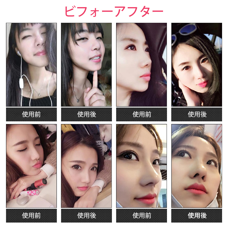 鼻クリップ ノーズクリップ 鼻 高く 美鼻 小鼻 鼻用 ノーズフィット サポート グッズ 軽量 シリコン 男女兼用 フィット アイテム ケアグッ_画像6