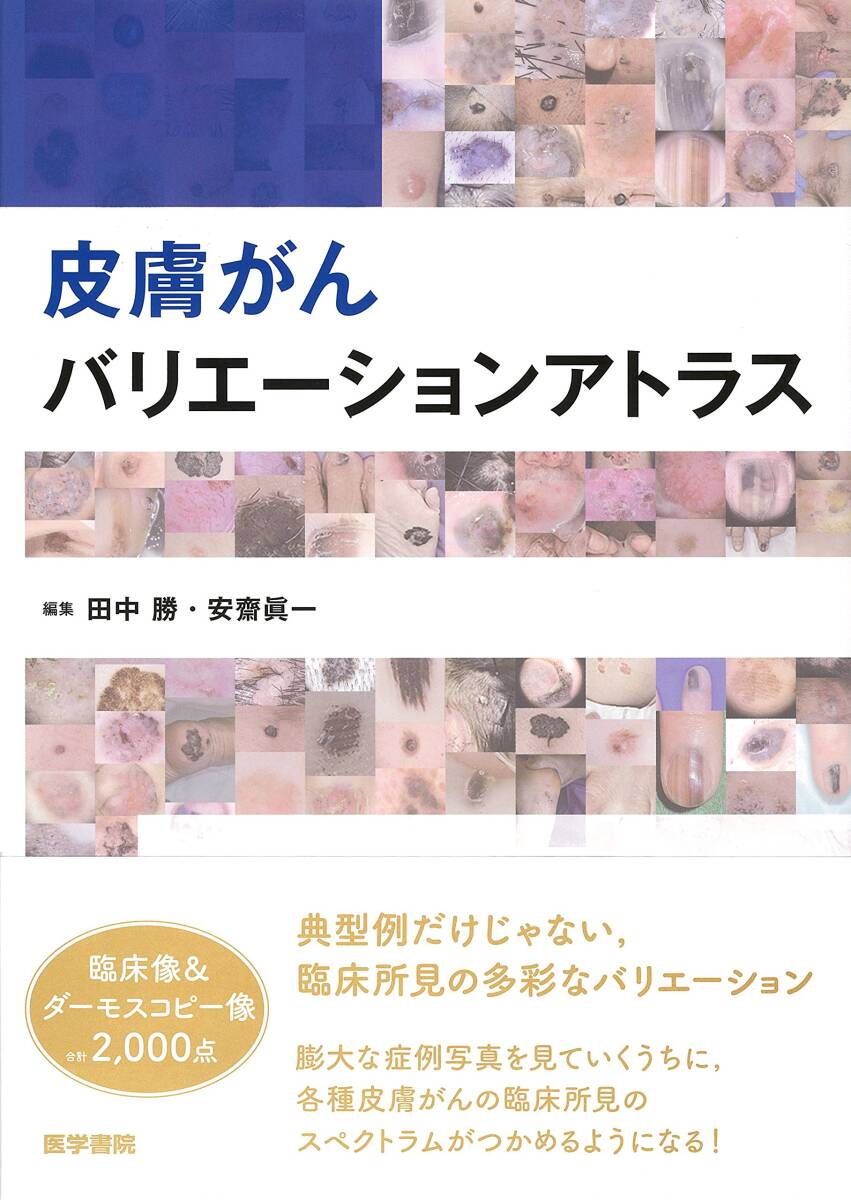 比較血液型学 鈴木 正三、 池本 卯典; 向山 明孝 比較血液型学(鈴木 正三 (監修) / 池本 卯典・向山 明孝 (編集