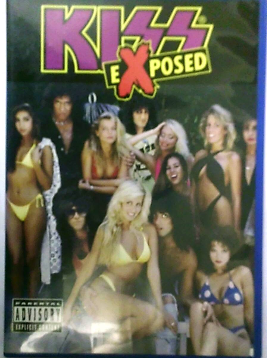 DVD KISS EXPOSED レンタル落ち_画像1