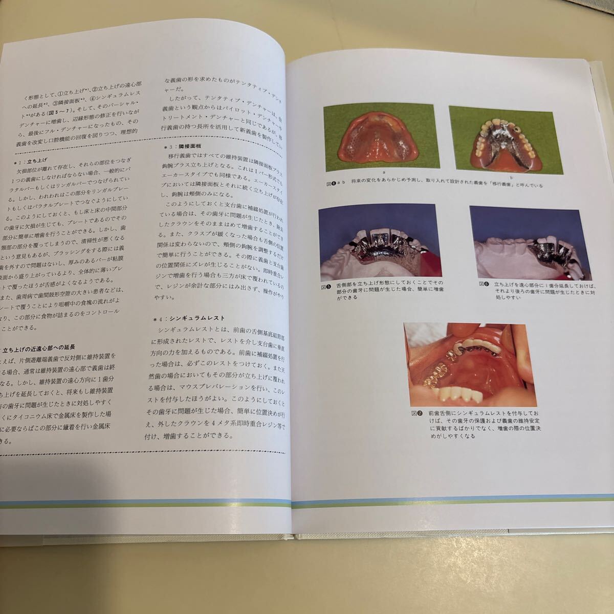 歯科本　究極の総義歯　村岡博著　デンタルダイヤモンド社　定価6,300円