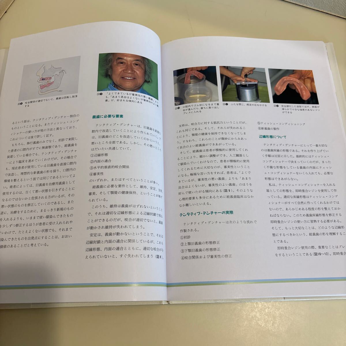 歯科本　究極の総義歯　村岡博著　デンタルダイヤモンド社　定価6,300円