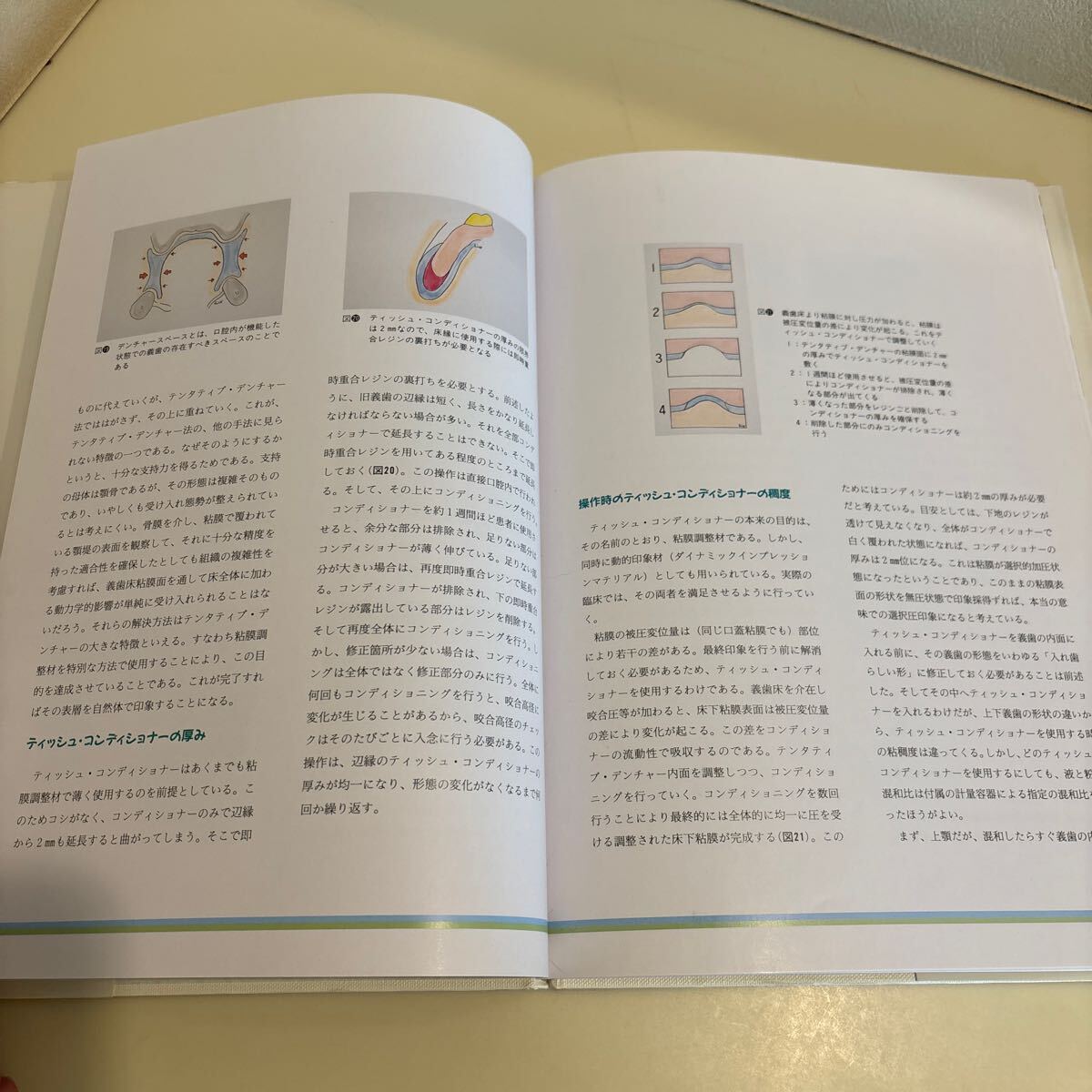 歯科本　究極の総義歯　村岡博著　デンタルダイヤモンド社　定価6,300円