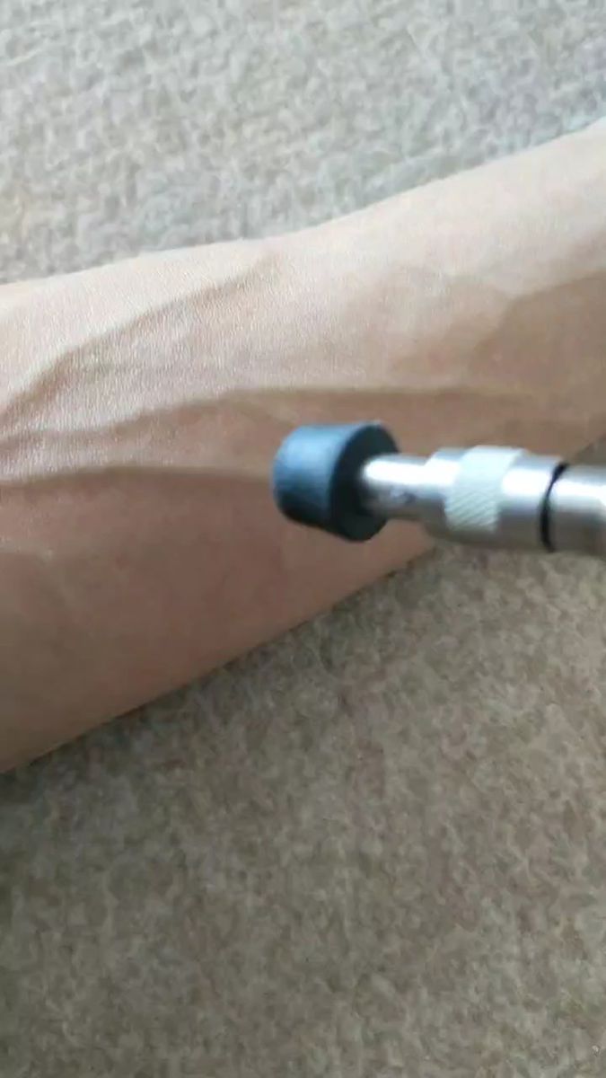 アクティベータ