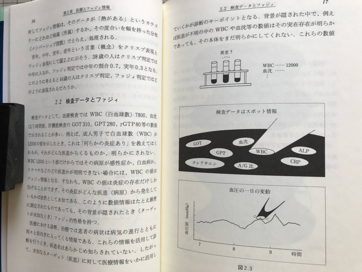 『メディカル・ファジィのはなし Science and technology』有田清三郎 日刊工業新聞社 1992年※医療とファジィ情報・医療への応用 他 05609_画像6