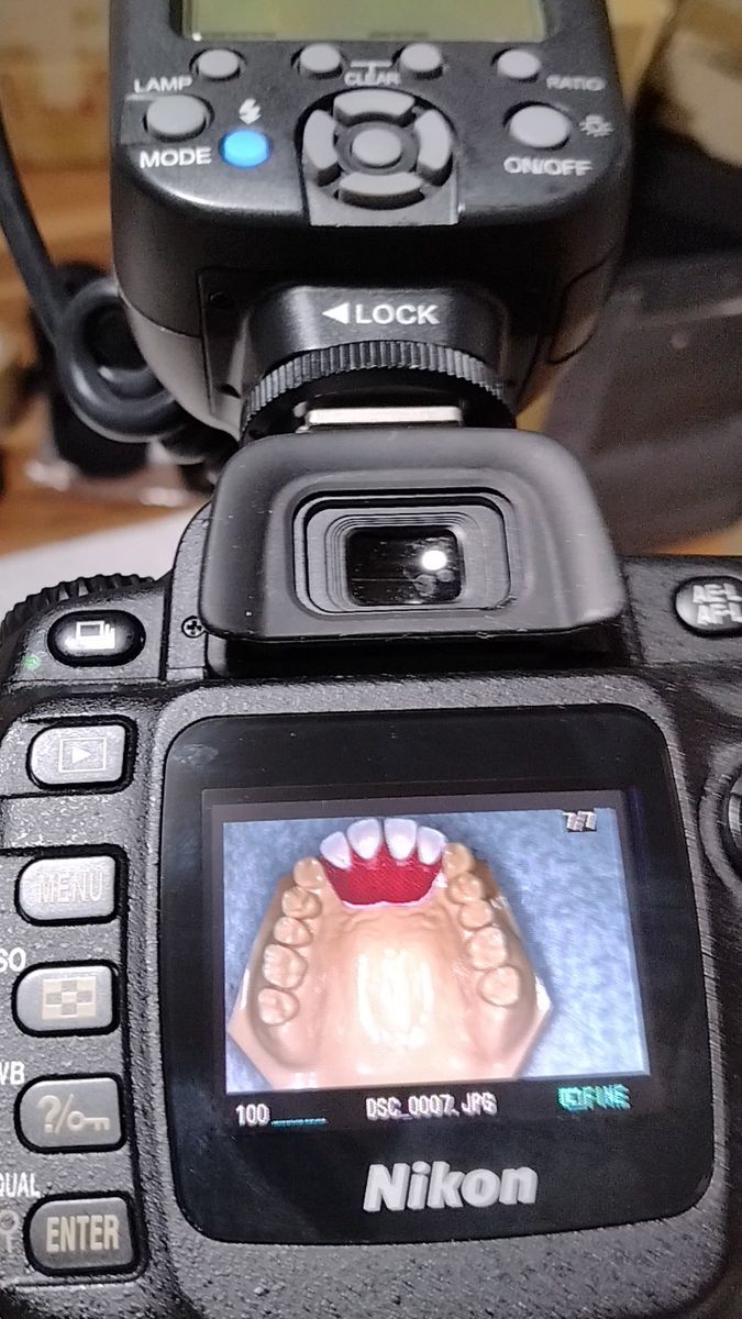 ニコンD50 マクロ撮影セット 口腔内写真OK