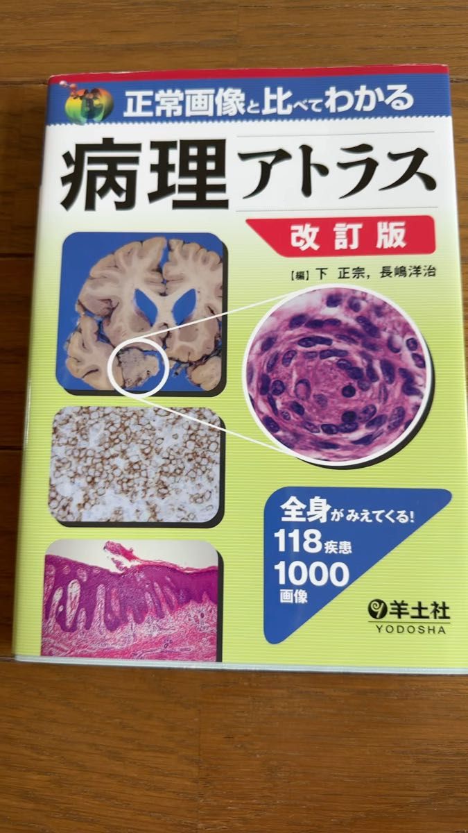 正常画像と比べてわかる病理アトラス 全身がみえてくる!118疾患1000画像 (改訂版) 下正宗/編 長嶋洋治/編