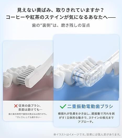 968 電動歯ブラシ エペイオス(Epeios) 二重振動電動歯ブラシ 歯ブラシ 電動 ブラシヘッド2本 IPX7 防水 Type-C 充電式 45日間使用_画像8