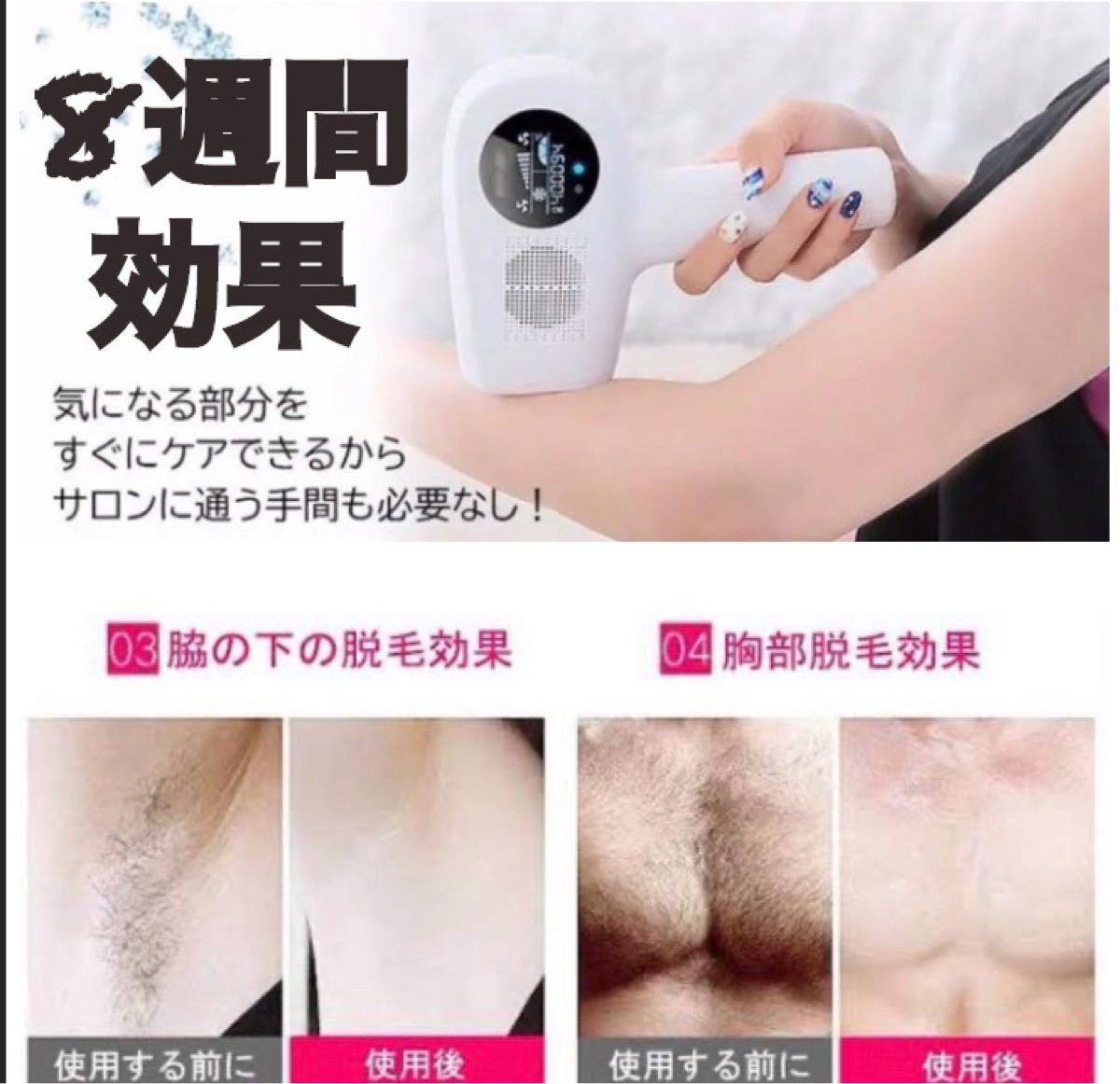 新品　脱毛器 光脱毛 無痛 全身用 フラッシュ レーザー  脱毛 IPL 美肌