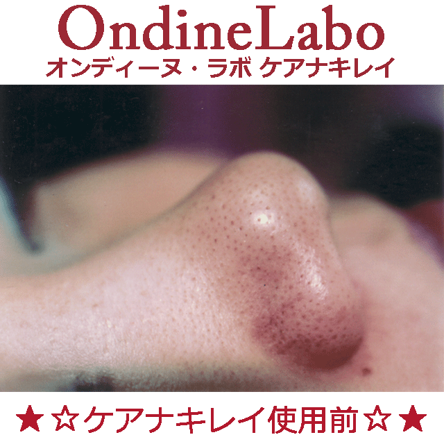 ★☆毛穴の汚れ＆毛穴の引き締め☆★ケアナキレイ＆スキンアップローションセット_画像3