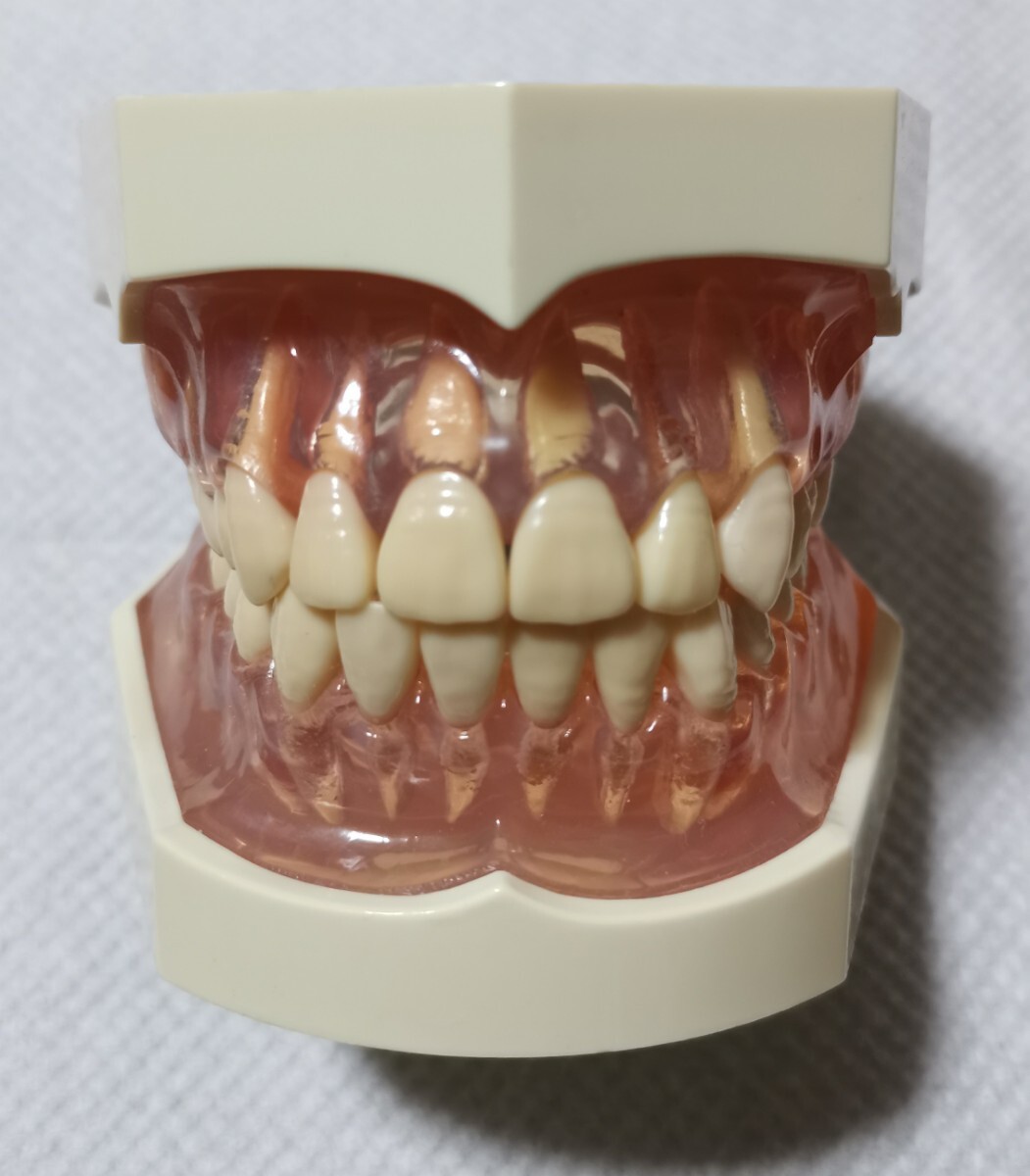 シンプルマネキンIII 歯科 NISSIN ニッシン 歯科用模型 顎模型 衛生士 シンプルマネキンIII 歯科 NISSIN ニッシン 歯科用模型 顎模型