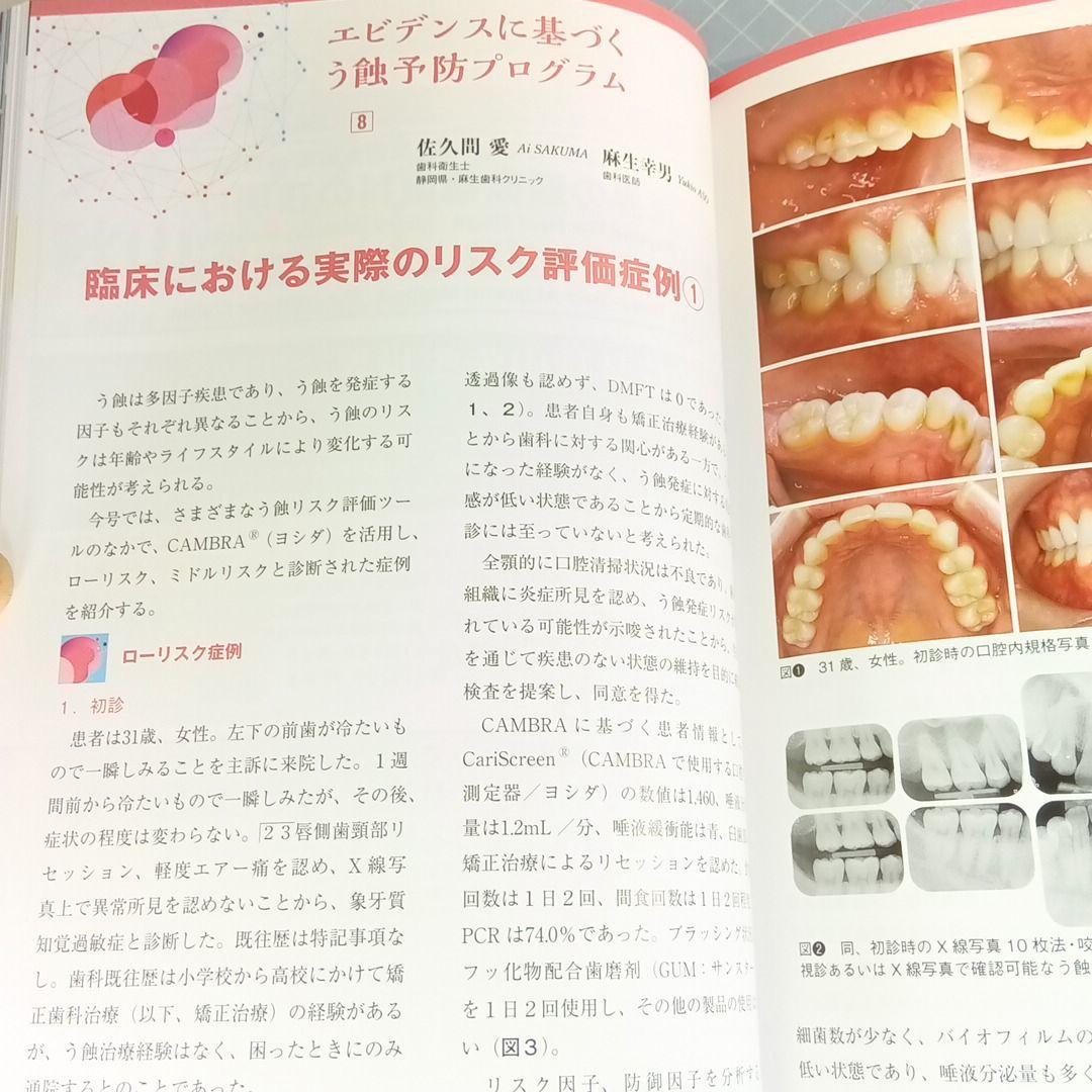 デンタルダイヤモンド　2025年6月号　デジタル時代のパーシャルデンチャー_画像8