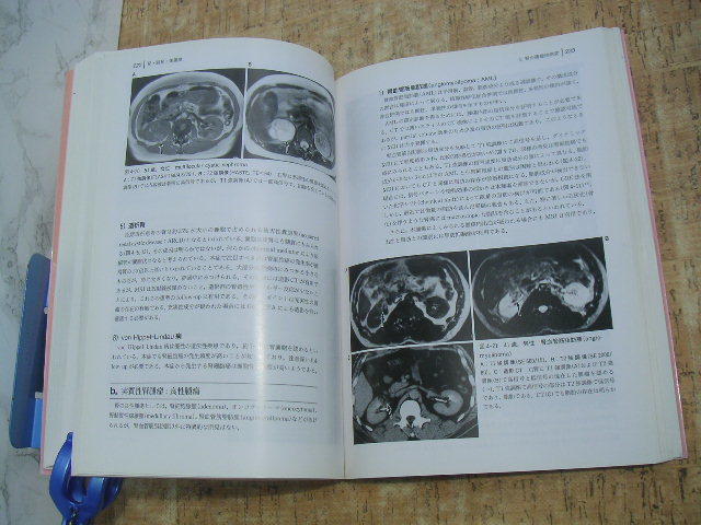 -. часть. MRI. дерево сила, работа medical наука Inter National,.2000 год * no. 1 версия * стоимость доставки 370 иен *