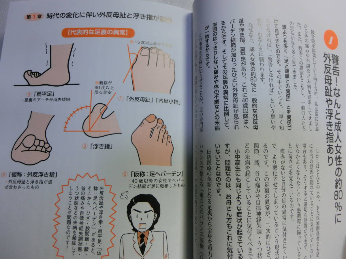 ヤフオク 自分で治す 外反母趾 笠原巖 完全図解 自分