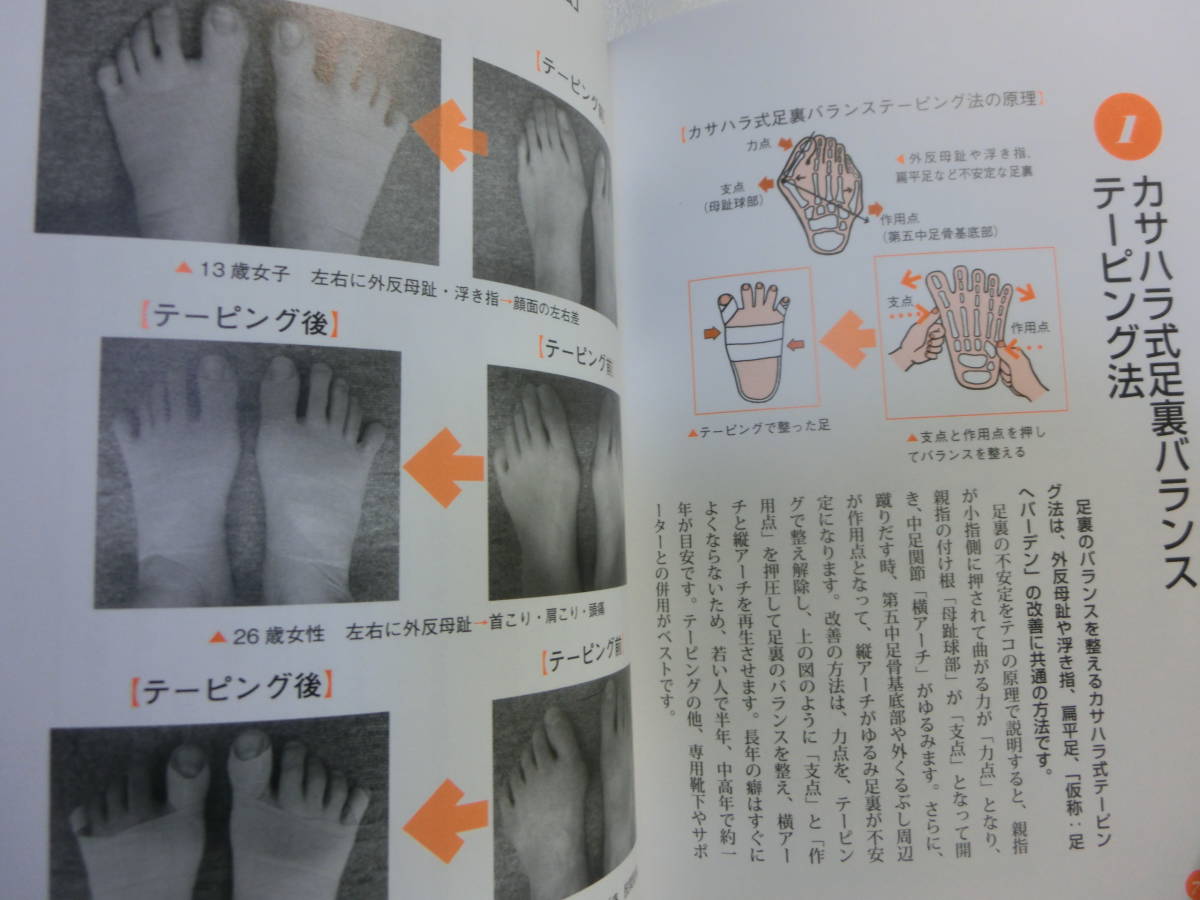 ヤフオク 自分で治す 外反母趾 笠原巖 完全図解 自分 ヤフオク 自分で治す 外反母趾 笠原巖 完全図解 自分