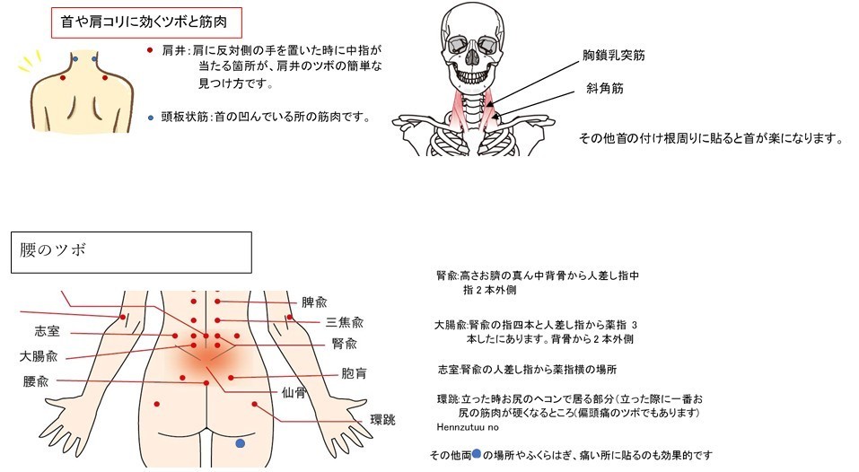 貼るだけ美容鍼(円皮鍼)100本 貼る場所の説明入り 肩こり 頭痛や足の