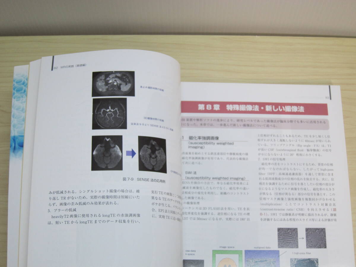 MRの実践―基礎から読影まで (診療画像検査法)_画像10