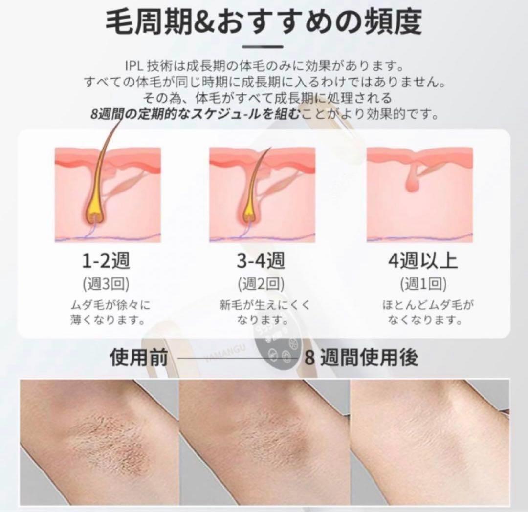脱毛器 IPL光脱毛器 セルフ 新品未開封_画像5