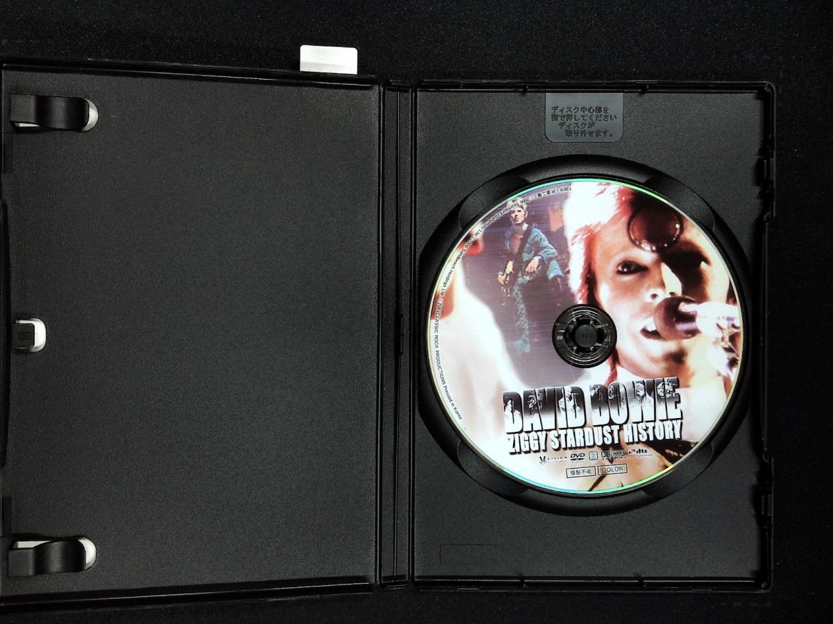 7958 DVD デヴィッド・ボウイ　ジギースターダスト・ヒストリー_画像2