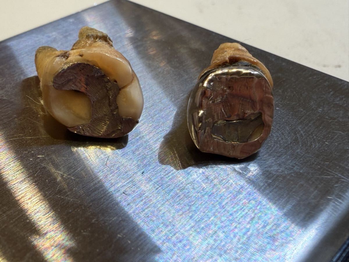 5.9g зуб есть 2 шт удаление . зуб . материал серебряный .pa радиоконтроллер um.. неизвестен серебряный зуб