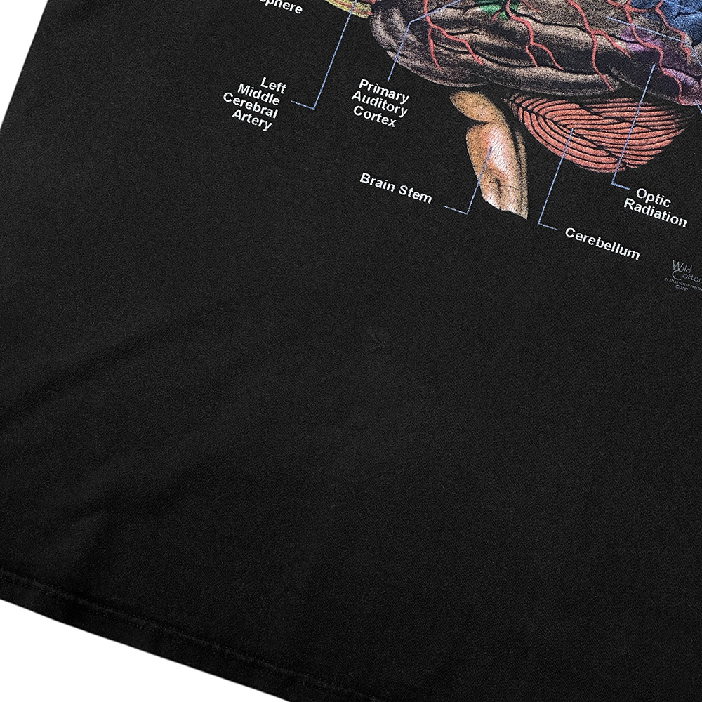 00s ビンテージ ANATOMICAL 脳みそ Tシャツ XL 黒 フェードブラック anvil アナトミカル ブレイン ヘッド 解剖 人体 模型 90s USA 古着_画像9