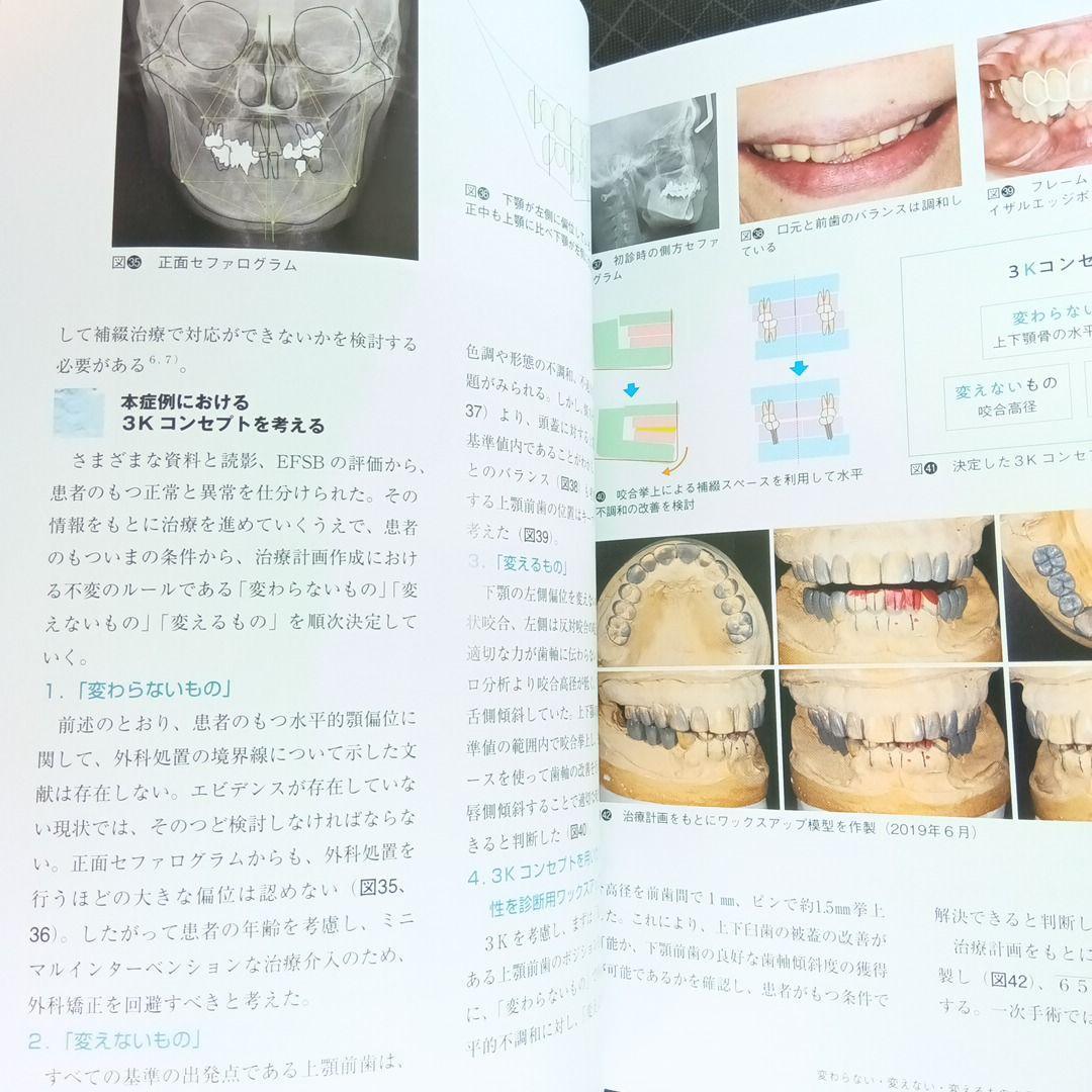 デンタルダイヤモンド　2025年4月号　3Kコンセプトを軸とした歯科治療_画像8