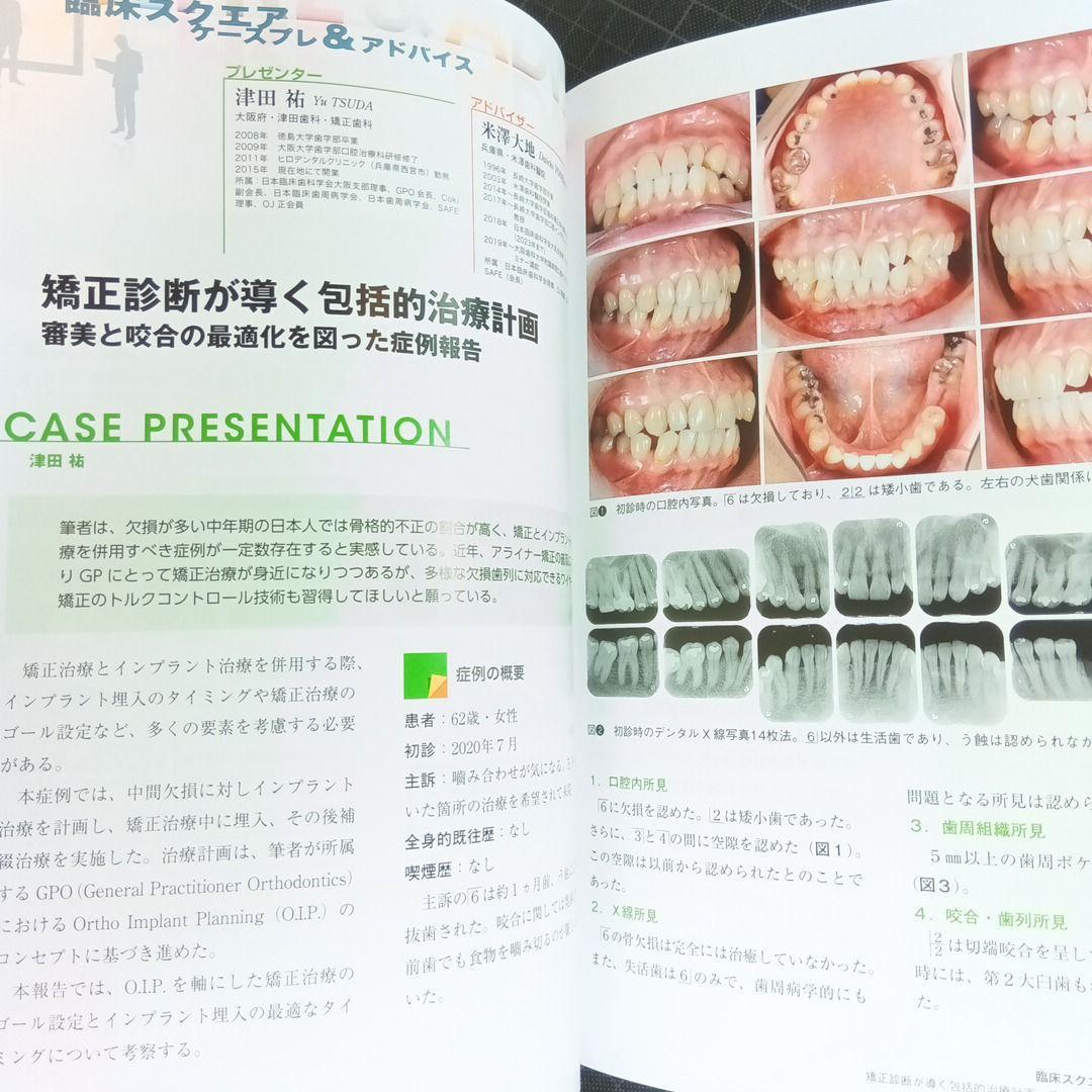 デンタルダイヤモンド　2025年4月号　3Kコンセプトを軸とした歯科治療_画像10