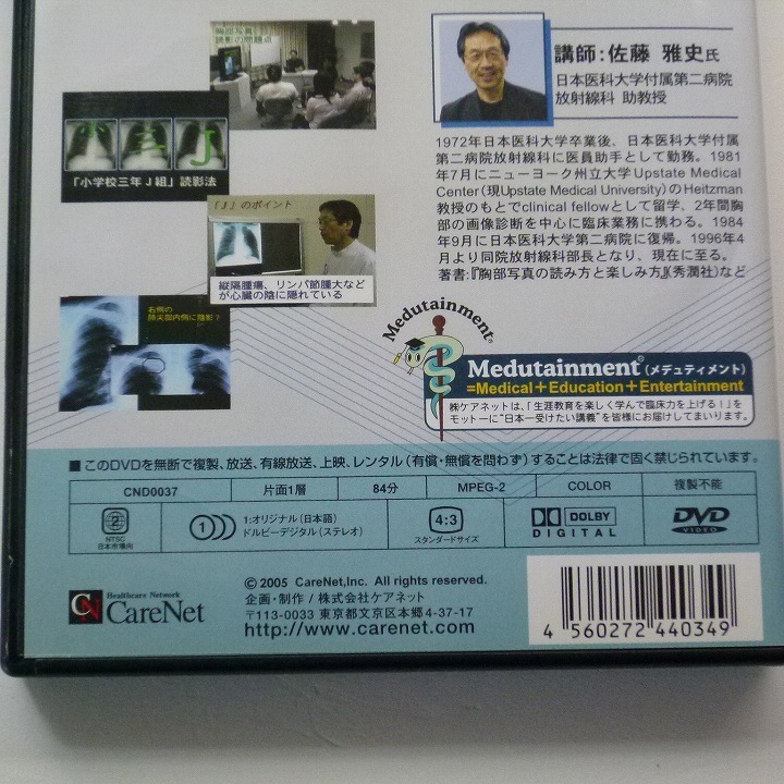 DVD Dr.佐藤の胸部写真の楽しみ方 上巻 佐藤雅史 ケアネット / 送料込み_画像5