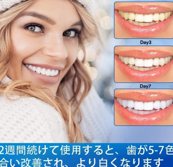 зуб промежуток уход зуб. пожелтение удаление чистка зубов простой . зуб промежуток уход 14 день минут