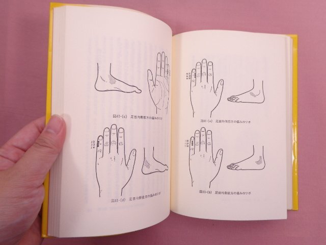 希少！ 『 てのひらツボ療法 高麗手指鍼の原理と応用 』 柳泰佑/著 地湧社_画像2