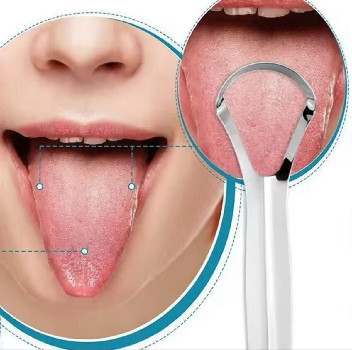 舌クリーナー 舌ブラシ ステンレス 口腔ケア 簡単！痛くない！しっかり取れる！スクレーパー リムーバー 口臭 マウスケア_画像2