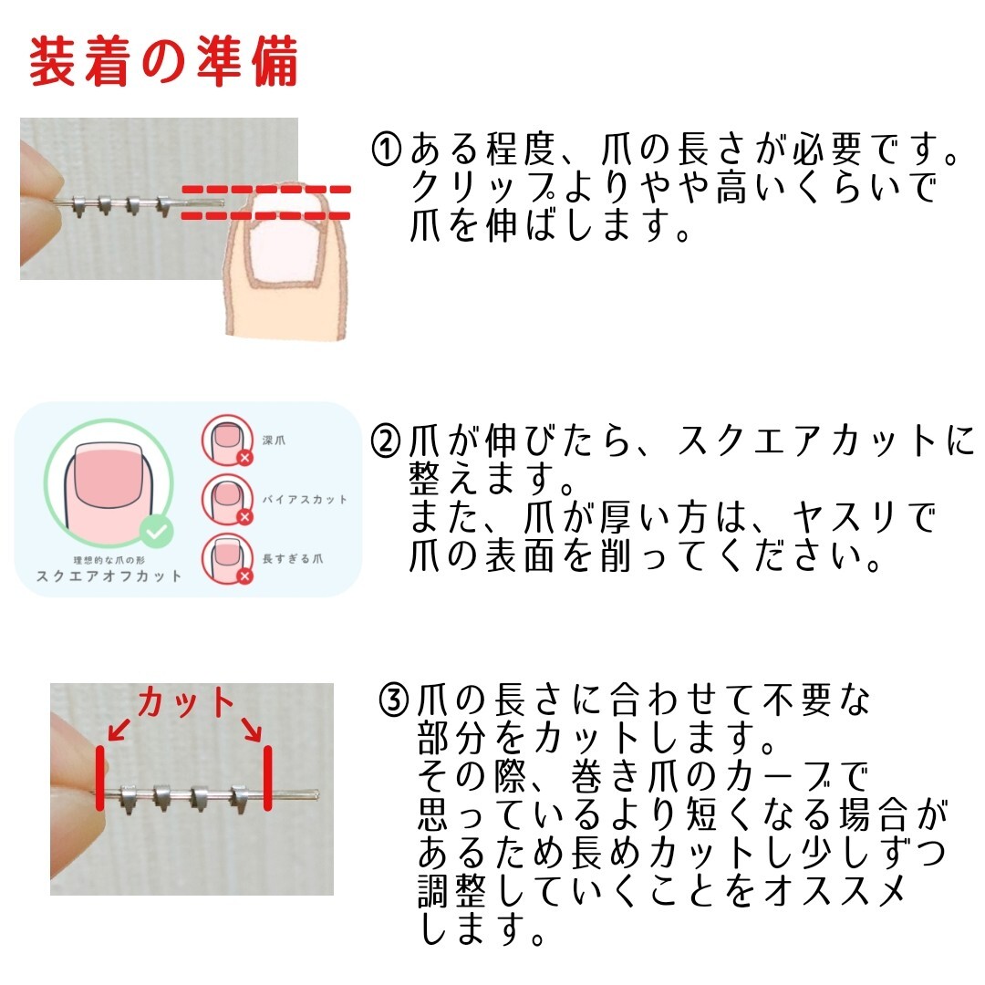 巻き爪矯正　セルフケア　ワイヤー　クリップ　陥入爪　巻き爪　フットケア　ネイルケア　巻き爪ケア　まきづめ　爪ケア_画像3