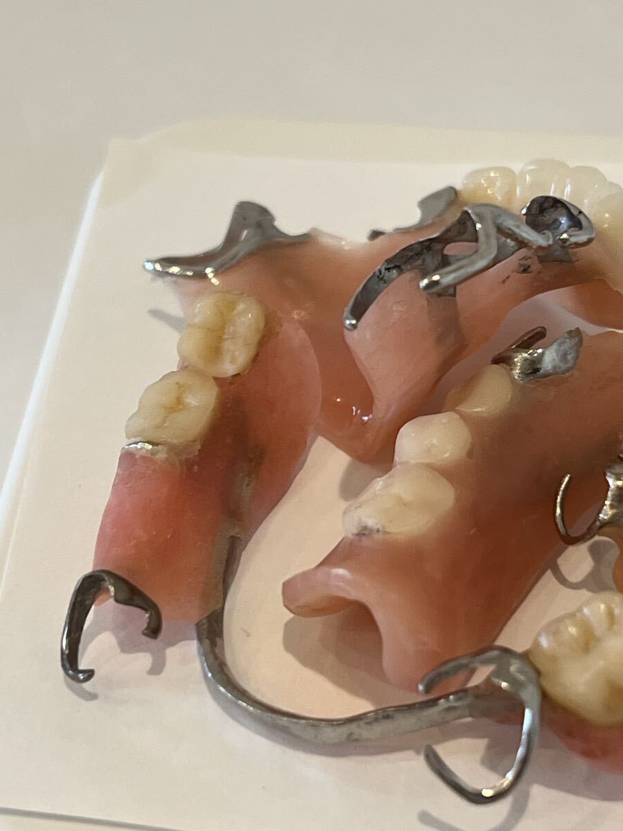 入れ歯 部分入れ歯 まとめて 40ｇ 銀歯 歯科 義歯 歯科技工 歯科金属_画像2