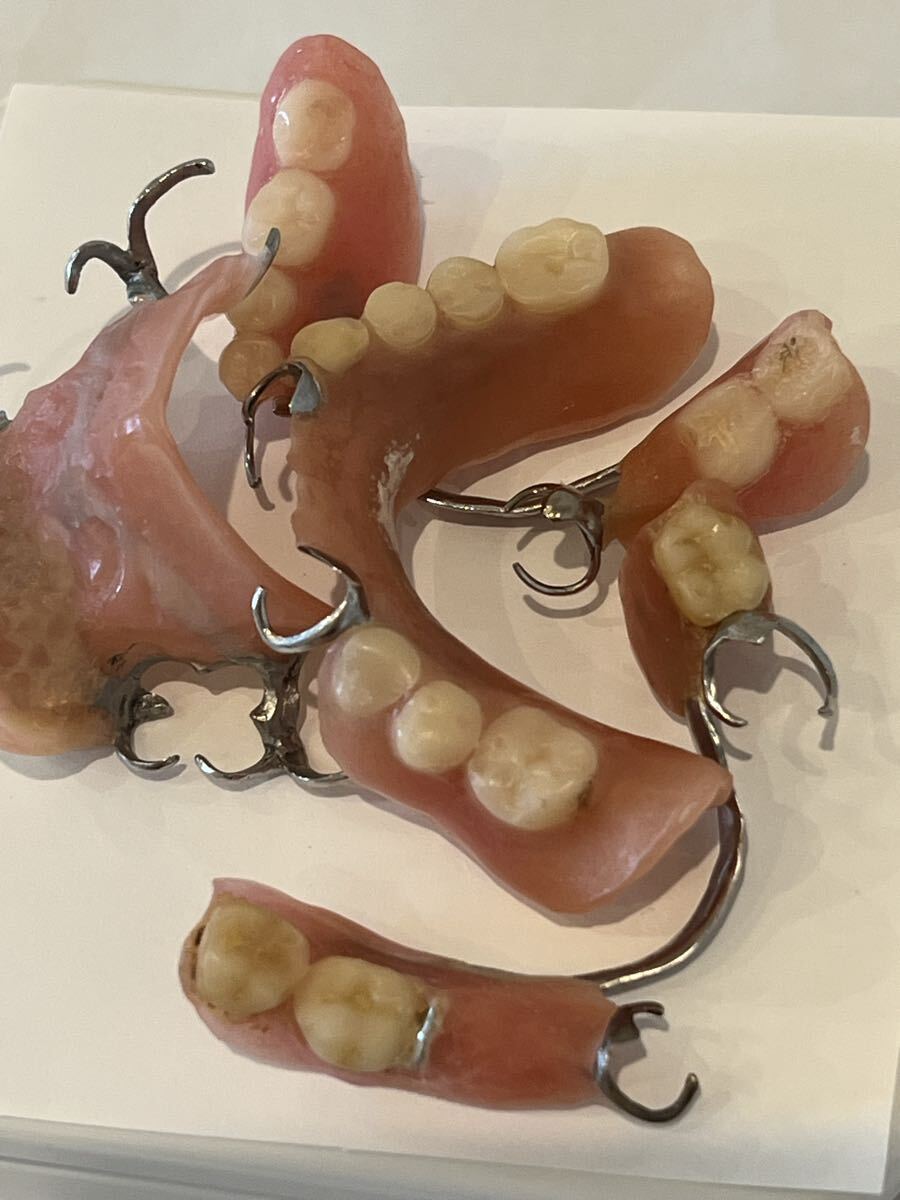 入れ歯 部分入れ歯 まとめて 40ｇ 銀歯 歯科 義歯 歯科技工 歯科金属_画像4